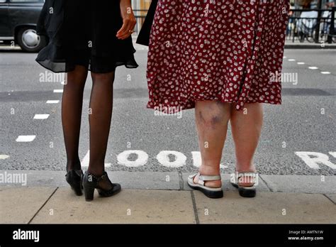 Zwei Frauen Mit Dicken Beinen Und Mit Dünnen Beinen Warten Eine