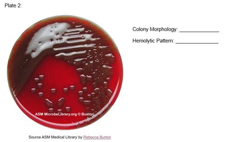 Solved Activity 1 Identify The Hemolytic Patterns On The Blood Agar
