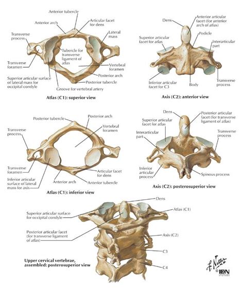 Odontoid fractures - Physiopedia