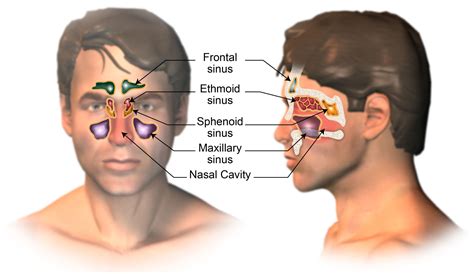 Nasal Cancer Pictures