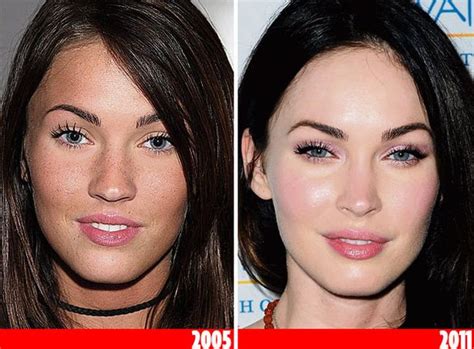 Which Celebrities Have Had Cosmetic Surgery Mirror Online