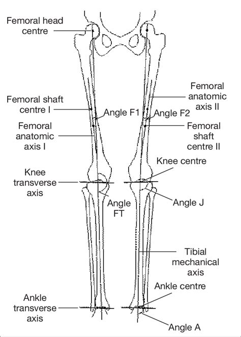 A free body diagram is defined as an illustration that depicts all the forces acting on a body, along with vectors that are applied by it on the immediate environs. Axes and angles of the lower limb | Download Scientific ...