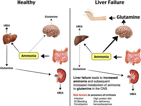 Get a definitive diagnosis hepatopathies such as cholangitis can be difficult protein restriction is only required in cats with hepatic encephalopathy; Rosh Review | Liver failure, Healthy liver, Emergency medicine