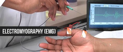 Electromyography Emg Procedure Purpose Risks