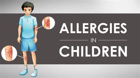 Allergies In Children I 1 Youtube