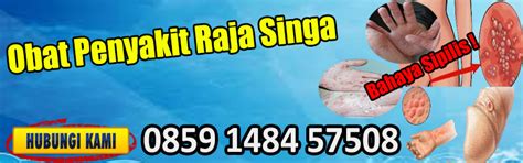 We did not find results for: Obat Penyakit Raja Singa