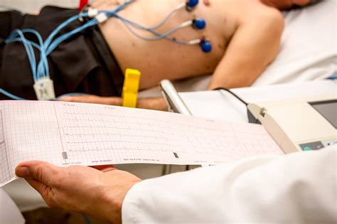 Lead Electrocardiogram Ecg In Australia Dr Arthur Nasis