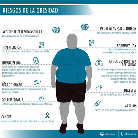 Infografía informativa sobre los riesgos de la obesidad supervisada por el equipo de