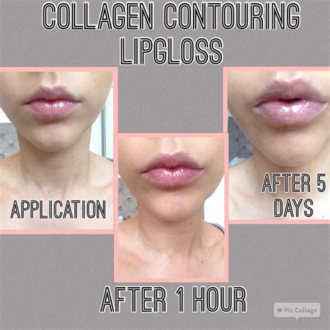 Collagen Contouring Lipgloss Enhancing The Natural Collagen In Your