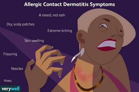 Allergic Contact Dermatitis Symptoms Causes Diagnosis More