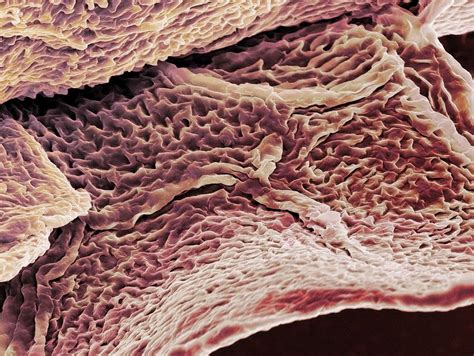 Skin Cells Under Microscope