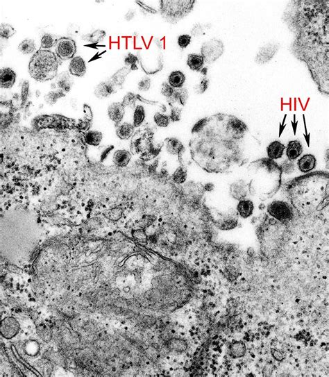 5 Virus Lidské Imunodeficience Hiv Bezplatné Obrázky