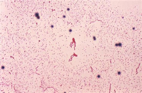 Bacillus Coagulans Sc208