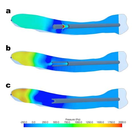 It's the last thing you do, but it also gives your paper a. (PDF) Irrigation of human prepared root canal - Ex vivo ...