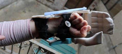 Disaster Relief Field Ready Bold Machines Create D Printed Prosthetic Hands More