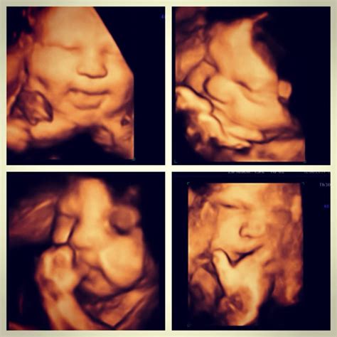 30 Weeks Pregnant 4d Ultrasound Nibhtwc