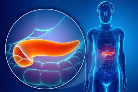 Хронический алкогольный панкреатит диета Хронический панкреатит: алкогольный и калькулёзный, причины, патогенез Хронический панкреатит: алкогольный и калькулёзный, причины, патогенез Хронический алкогольный панкреатит диета
