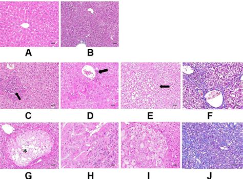 Histopathological Examination Of Mice Liver A And B Are Reference
