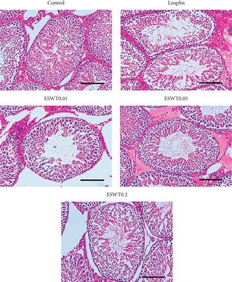 Pathological Appearance Of Testicular Tissue Hematoxylin And Eosin