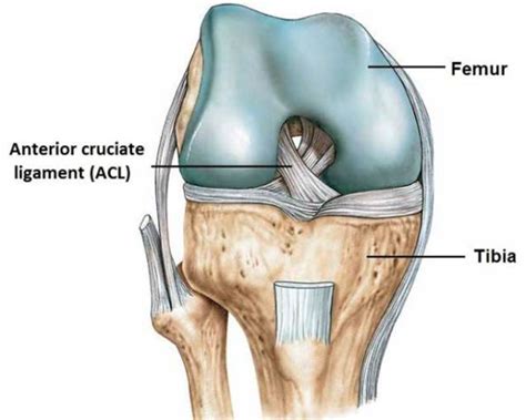 Anterior Cruciate Ligament Injury Acl Boise Acl Tear