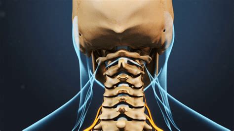 Cervical Radiculopathy Refers To A Set Of Symptoms That Can Be Caused