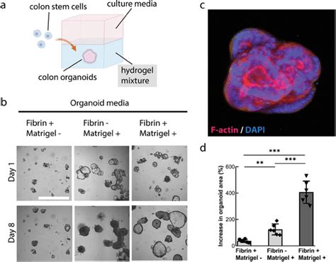 Optimization Of Hydrogel Matrices For Culturing Human Colon Organoids