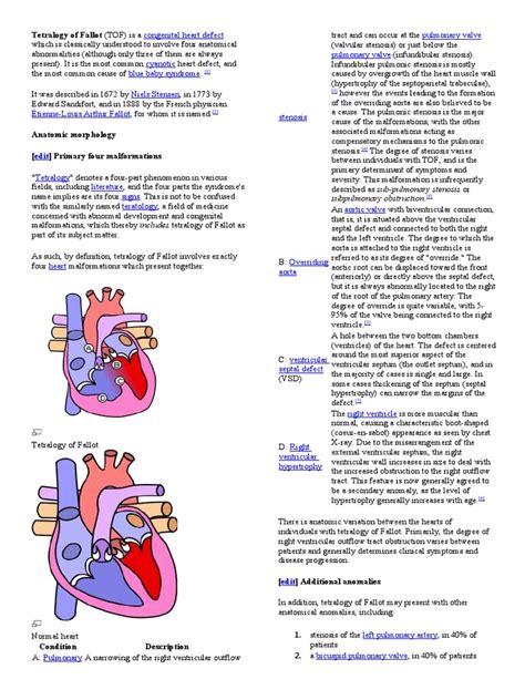 An In Depth Exploration Of Tetralogy Of Fallot Its Four Primary