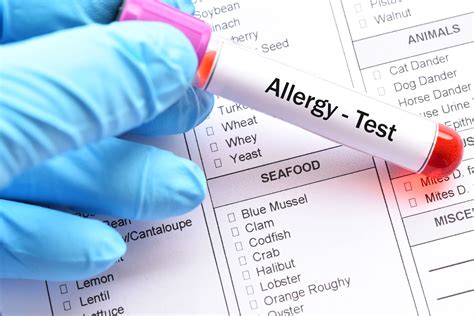 Kansas City Allergy And Asthma Associates Allergy Skin Testing