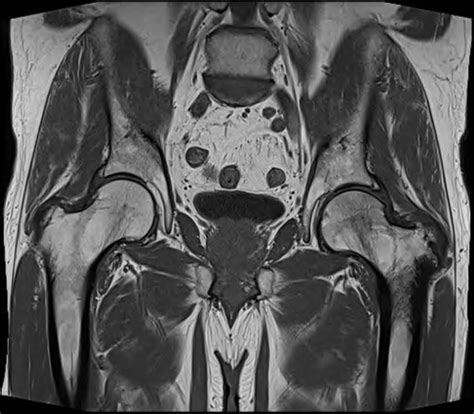 NCRG Magnetic Resonance Imaging MRI