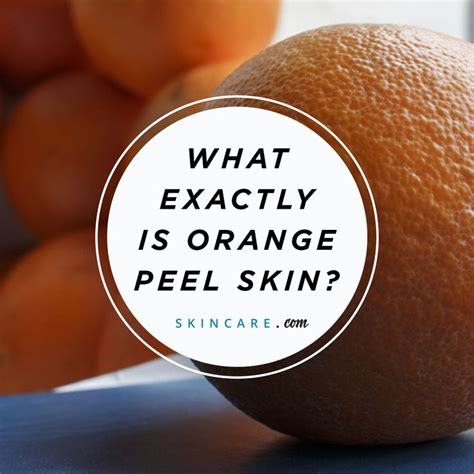 Although Orange Peel Skin Isnt A Scientific Condition The Term Does