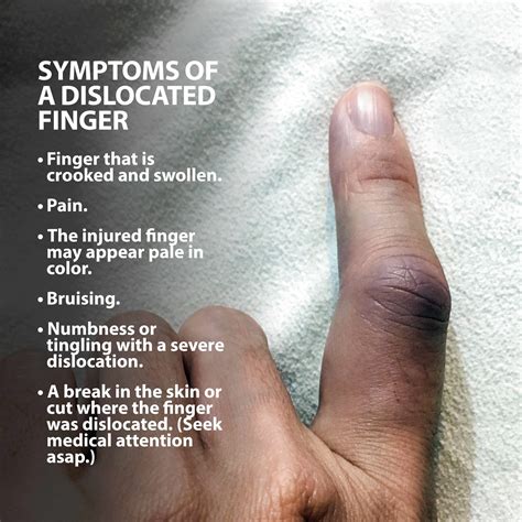 how to fix a dislocated finger
