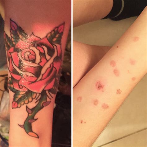 10 Scar Covering Tattoos With Amazing Stories Behind Them Bored Panda