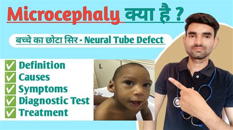 Microcephaly In Hindi Causes Symptoms And Treatment Of Microcephaly