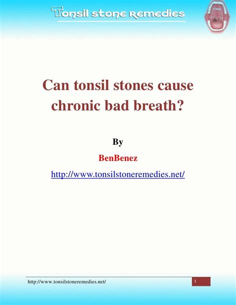 Can Tonsil Stones Cause Chronic Bad Breath