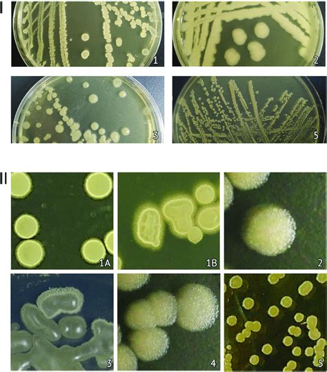 Bacterial Colony Morphology Identification Article Wi