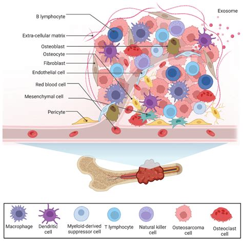 Cellular And Noncellular Components Of Os Tumor Microenvironment