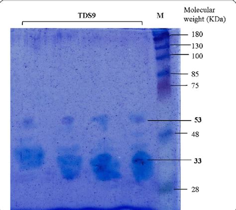 Photograph Of Sds Page Gel After Staining With Coomasie Blue Stain The