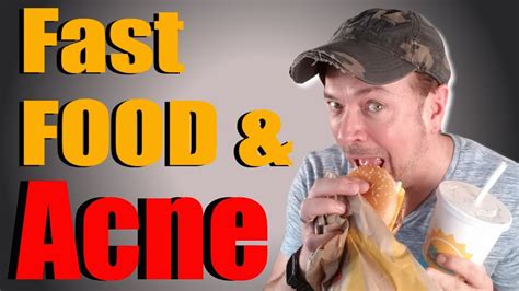 Does Fast Food Cause Acne Truth Or Bull S Chris Gibson Youtube