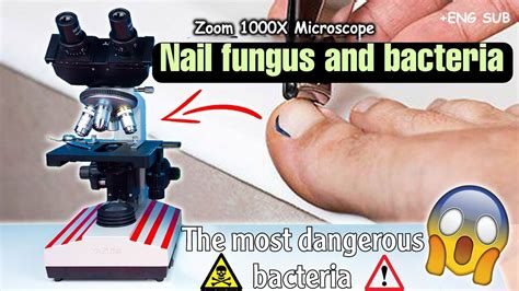 Nail Mass Under The Microscope Bacteria And Parasites Youtube