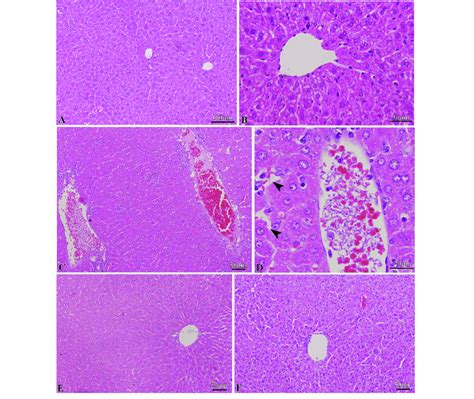 A And B Liver Histology Of Normal Mice Showing The Normal Liver C And