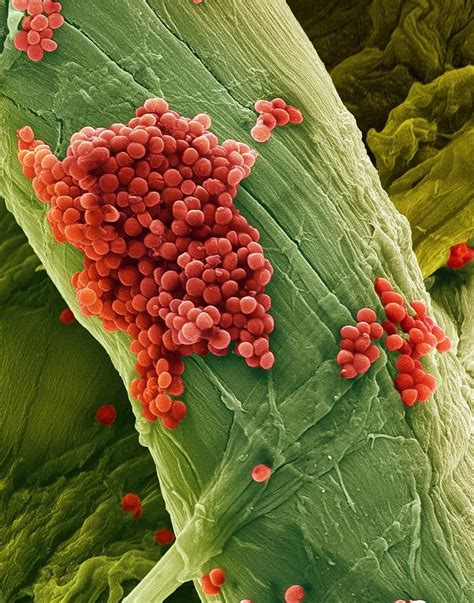 Streptococcus Pneumoniae Bacteria Sem Photograph By Steve Gschmeissner