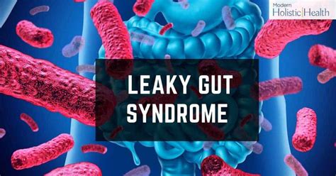 Natural Leaky Gut Syndrome Remedies Modern Holistic Health