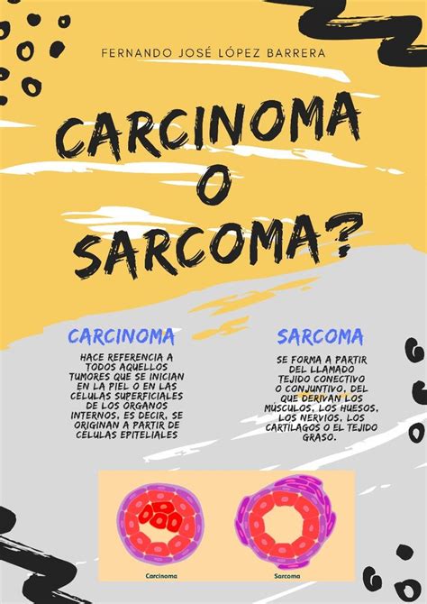 Diferencia Entre Carcinoma Y Sarcoma Sarcoma