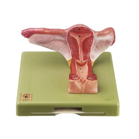 Female Genital Organs Somso Ms4