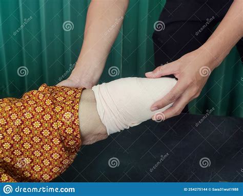 Below Knee Amputation Bandaging For Bk Prosthesis Stock Photo Image