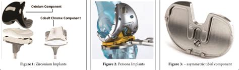 What Is New In Total Knee Replacement Journal Of Clinical Orthopaedics