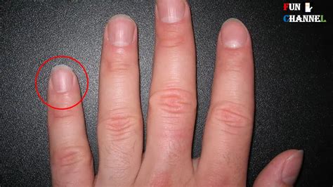 Do You Have Half Moon Shape On Your Nails Palmistry