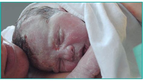 A Pele Do Recém Nascido Cuidar No Primeiro Ano De Vida