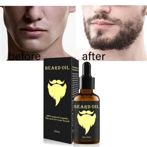 ginger oil men beard growth enhancer facial nutrition moustache grow beard shaping tool beard