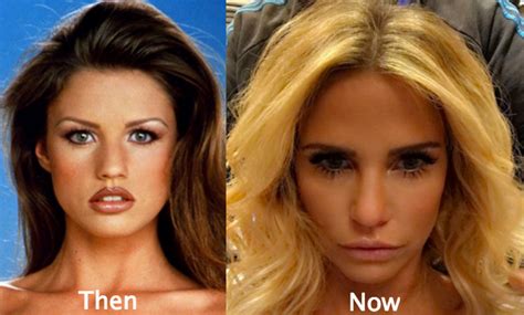 Katie Price Plastic Surgery Before And After Photos